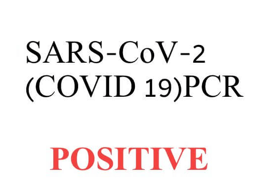 Covid-10 Positive